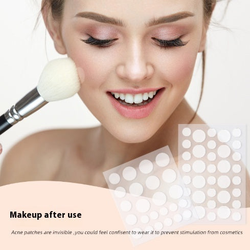 Despídete de los Granitos en Horas